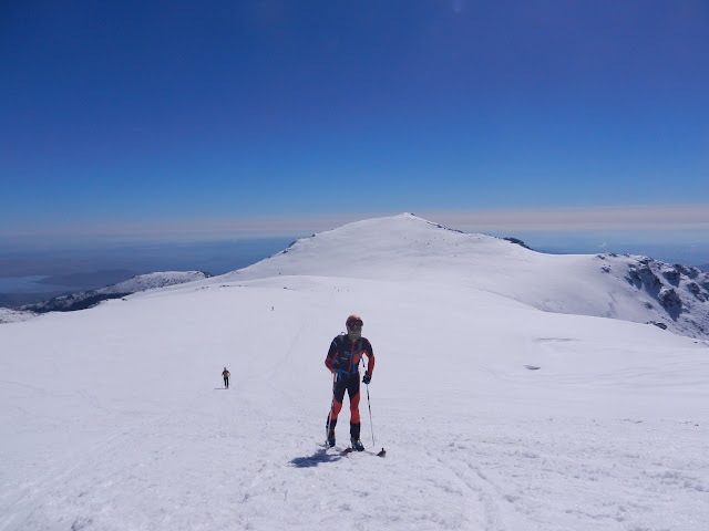 Muñeca rota / Guadarrama / Skimo